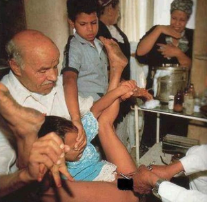 Female-genital-mutilation-11